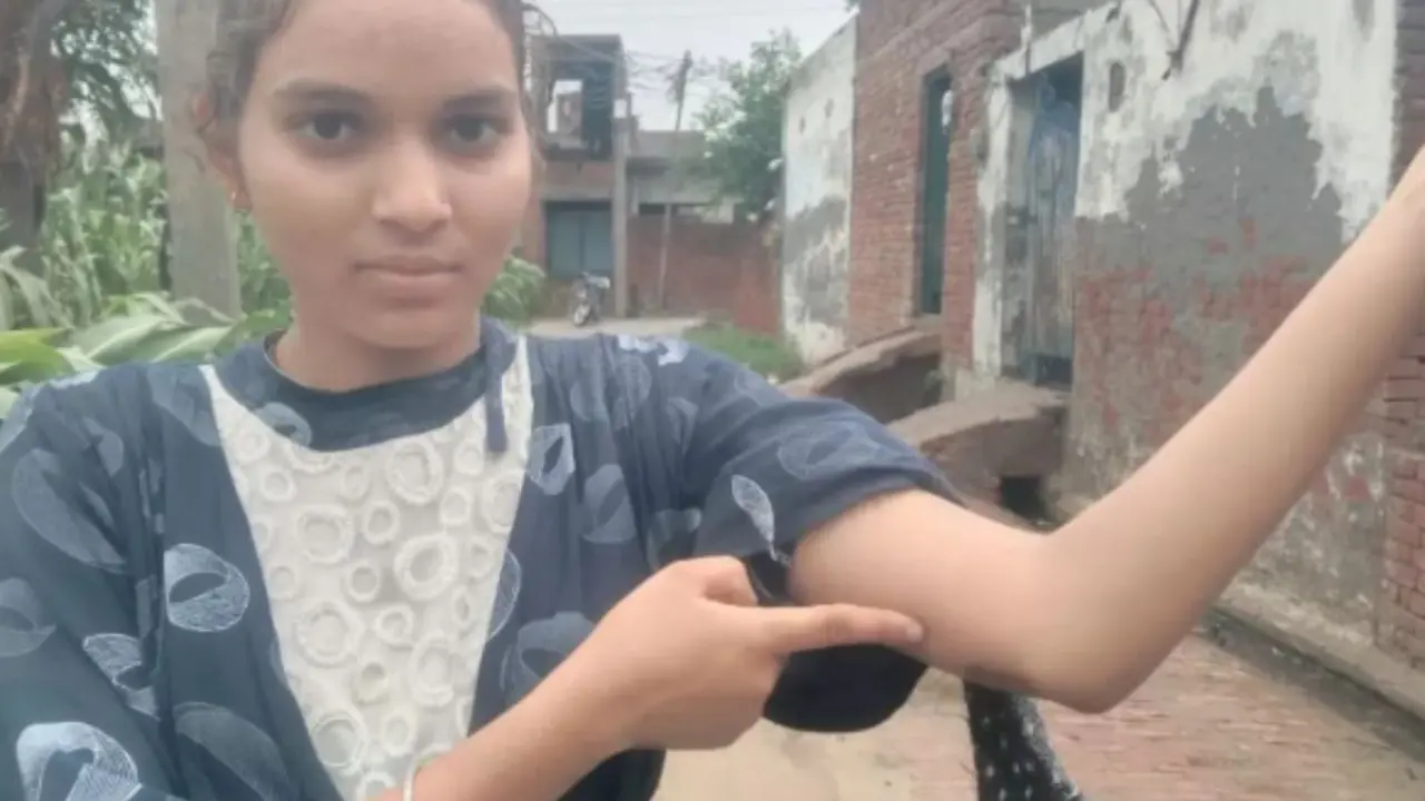 mysterious bug bites 22 person in 21 days