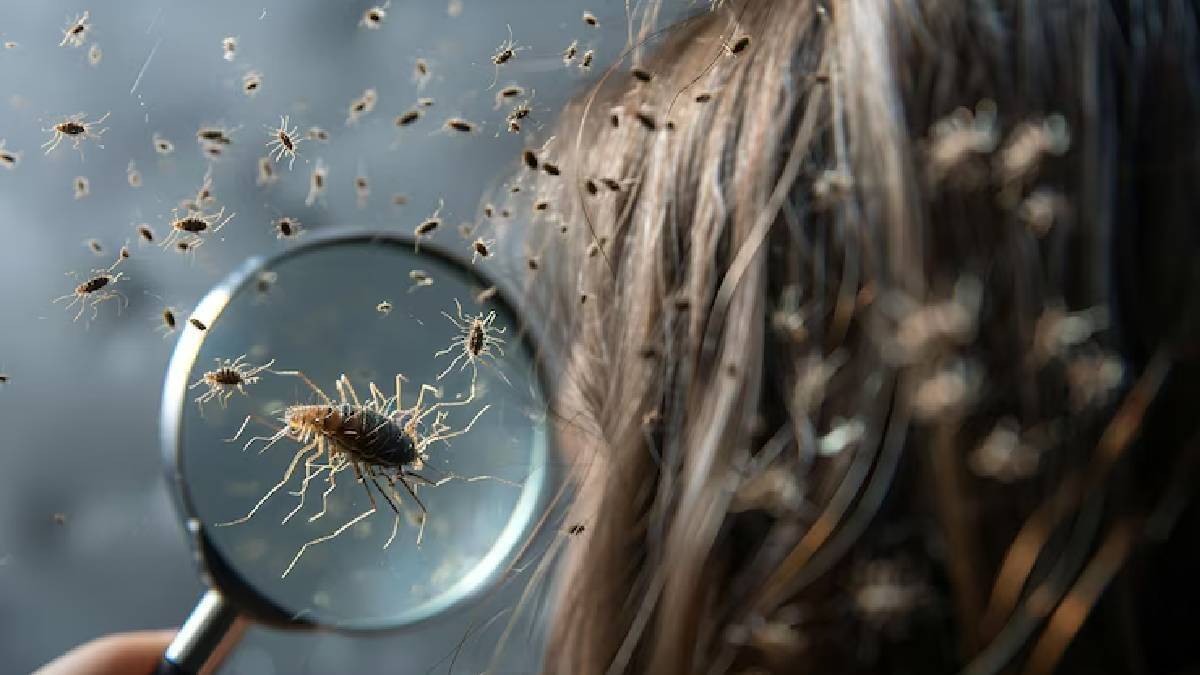 Description of the pic