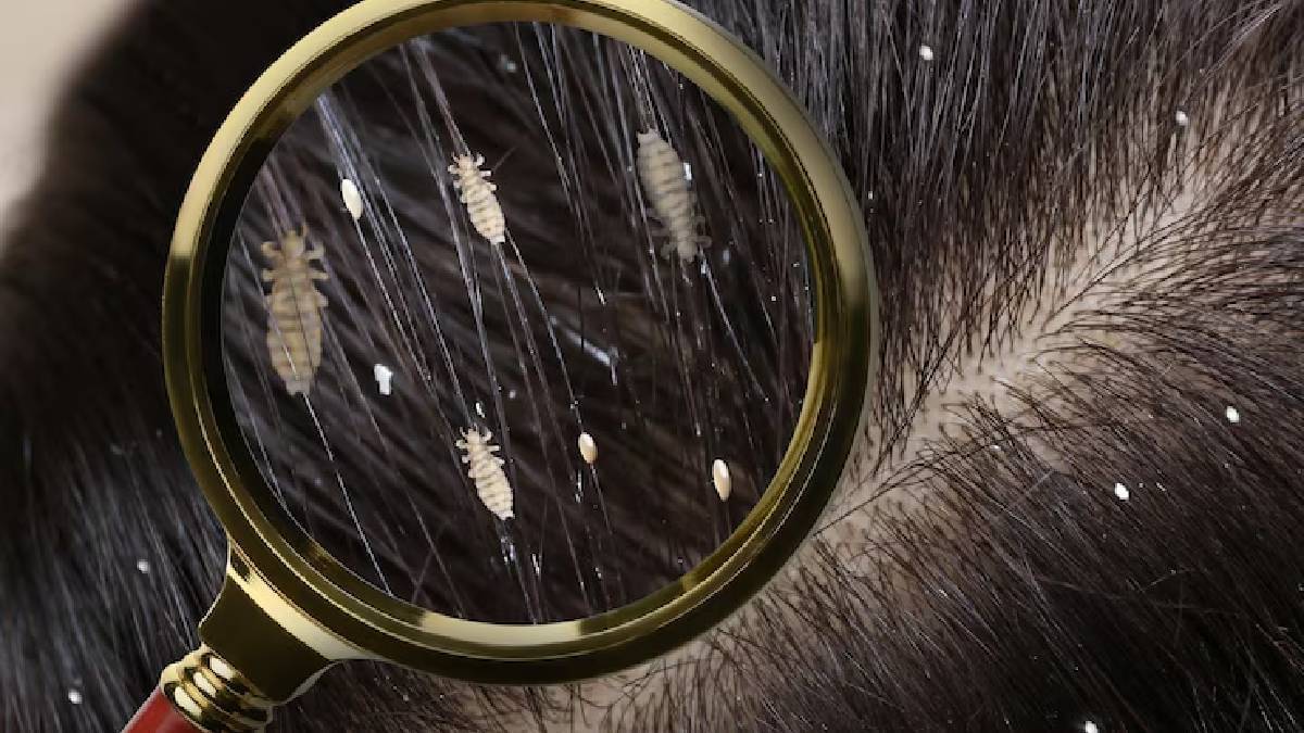 Description of the pic