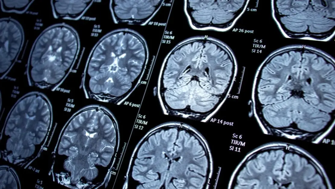 One nurse, who wishes to remain anonymous, shared her unsettling experience after being diagnosed with a brain tumor.