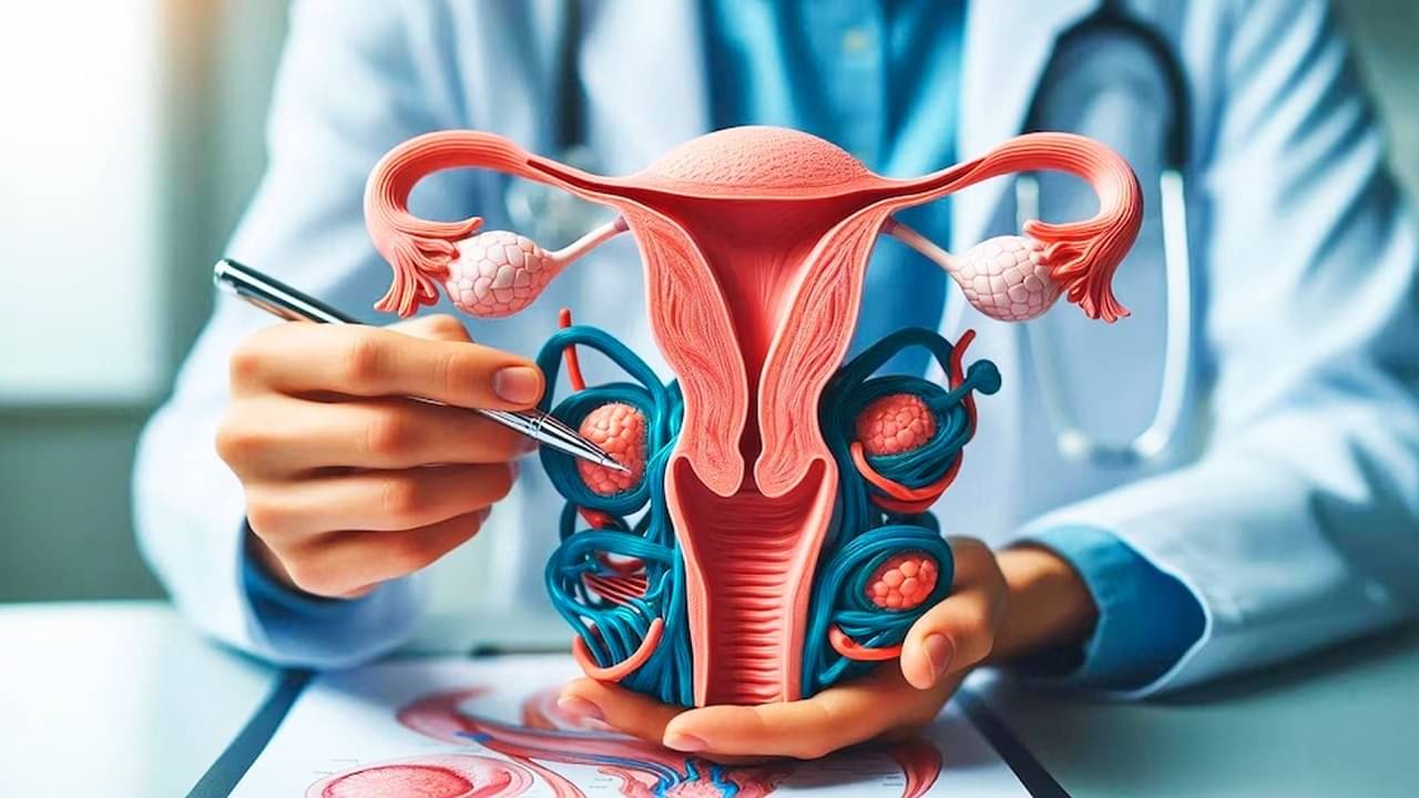 Description of the pic