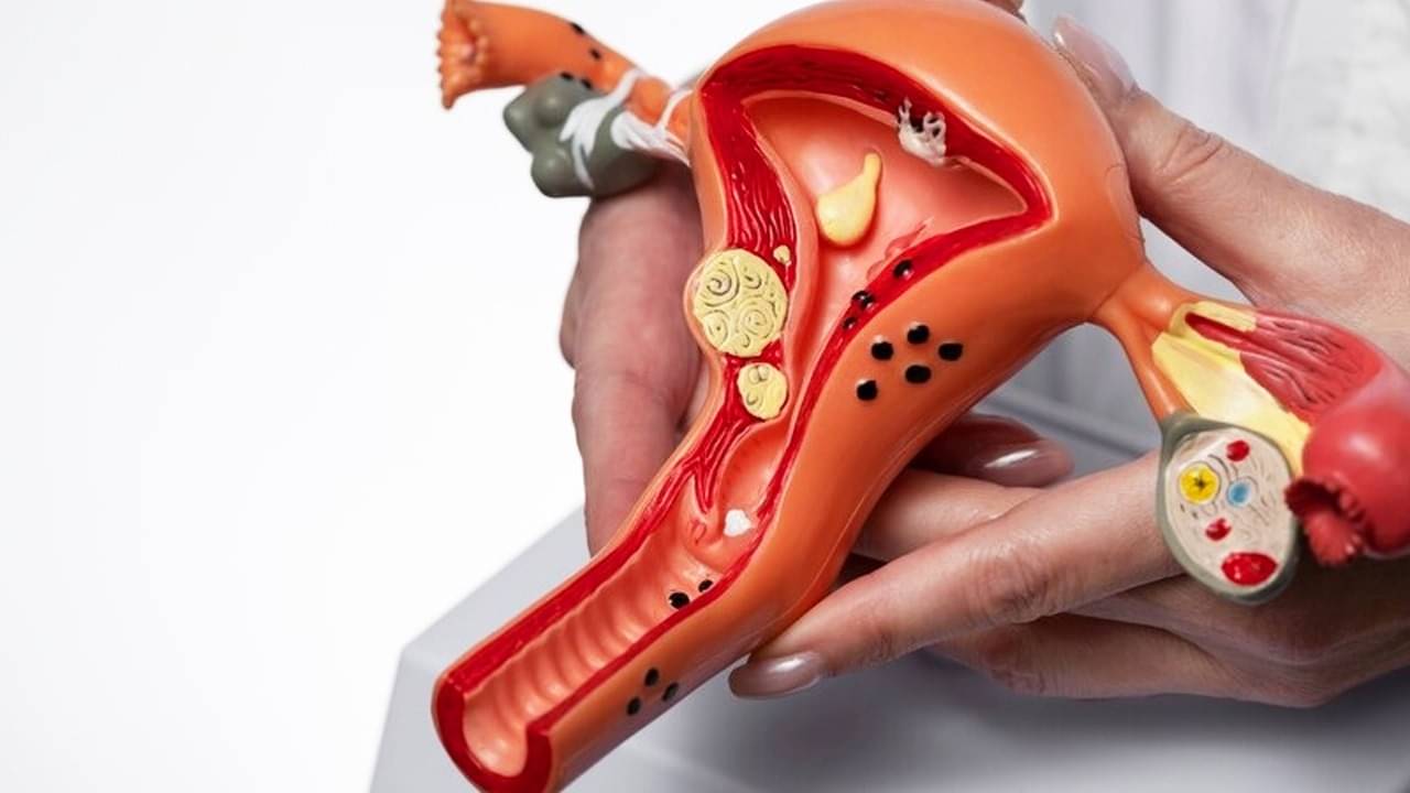 Description of the pic