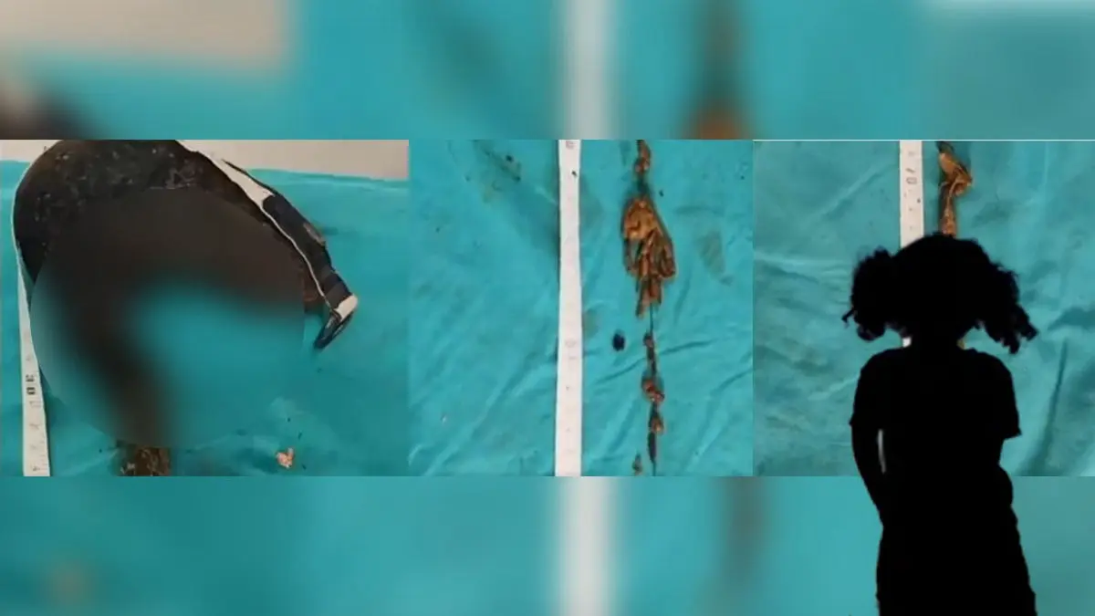 Pica - a mental disorder. People compulsively eat non-edible items.