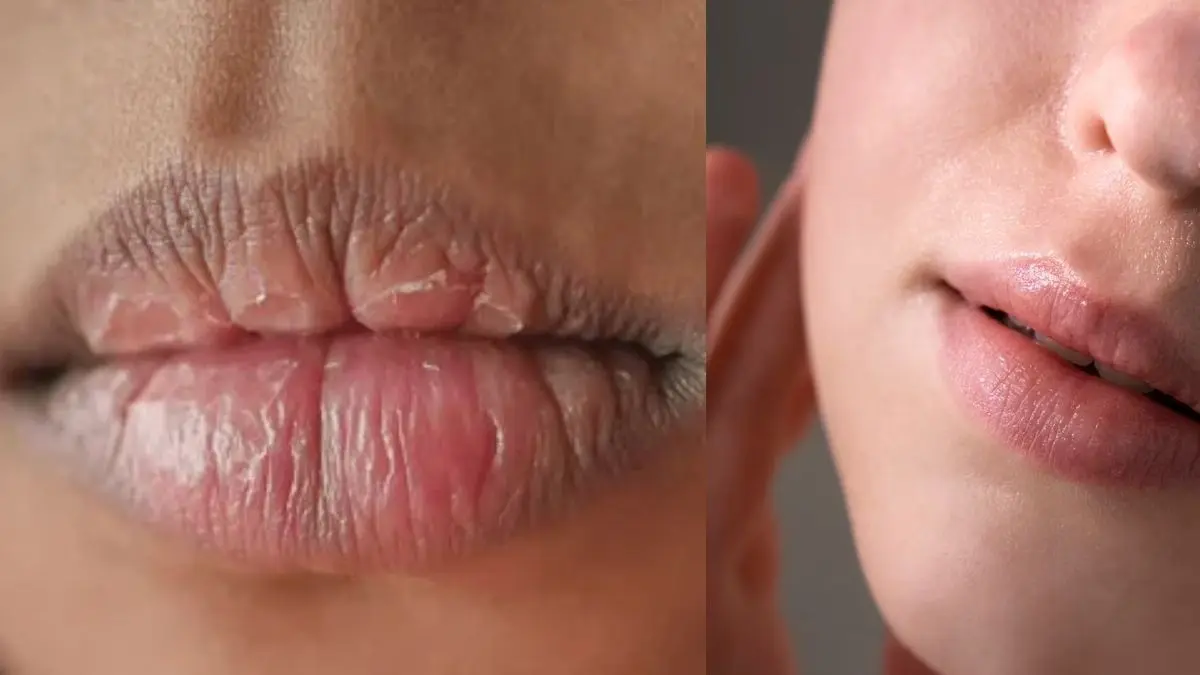 Pink Lips: घर पर होठों को बनाएं गुलाबी और मुलायम, फ्री में इस घरेलू स्क्रब का करें इस्तेमाल Pink Lips