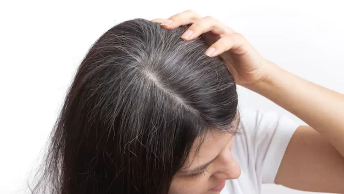 White Hair: कम उम्र में सफेद बालों की परेशानी से पाएं छुटकारा? जानिए ये देसी नुस्खा जो आपकी करेगा मदद premature grey hair