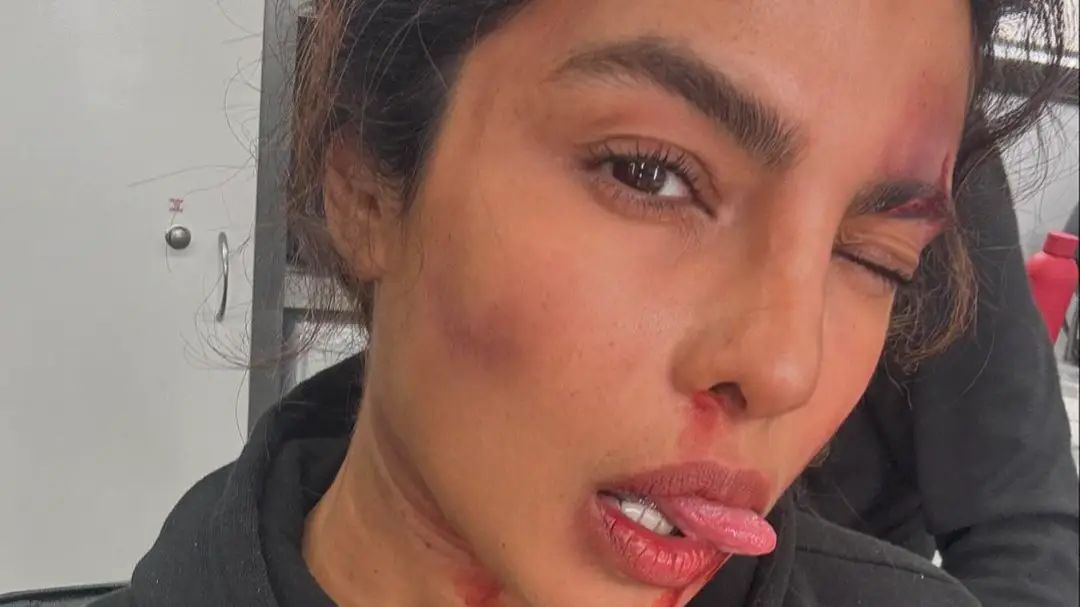 Description of the pic