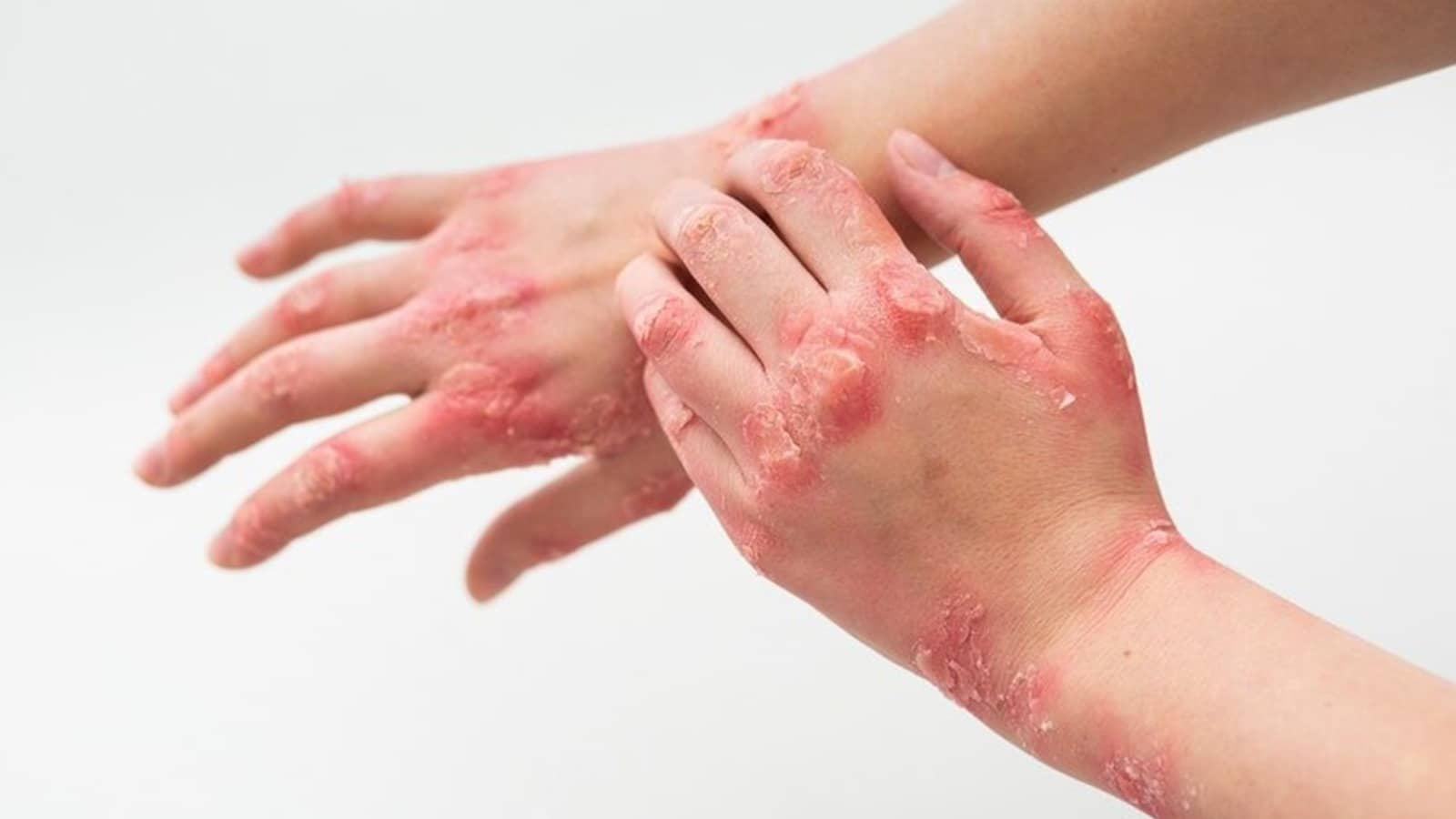 Description of the pic