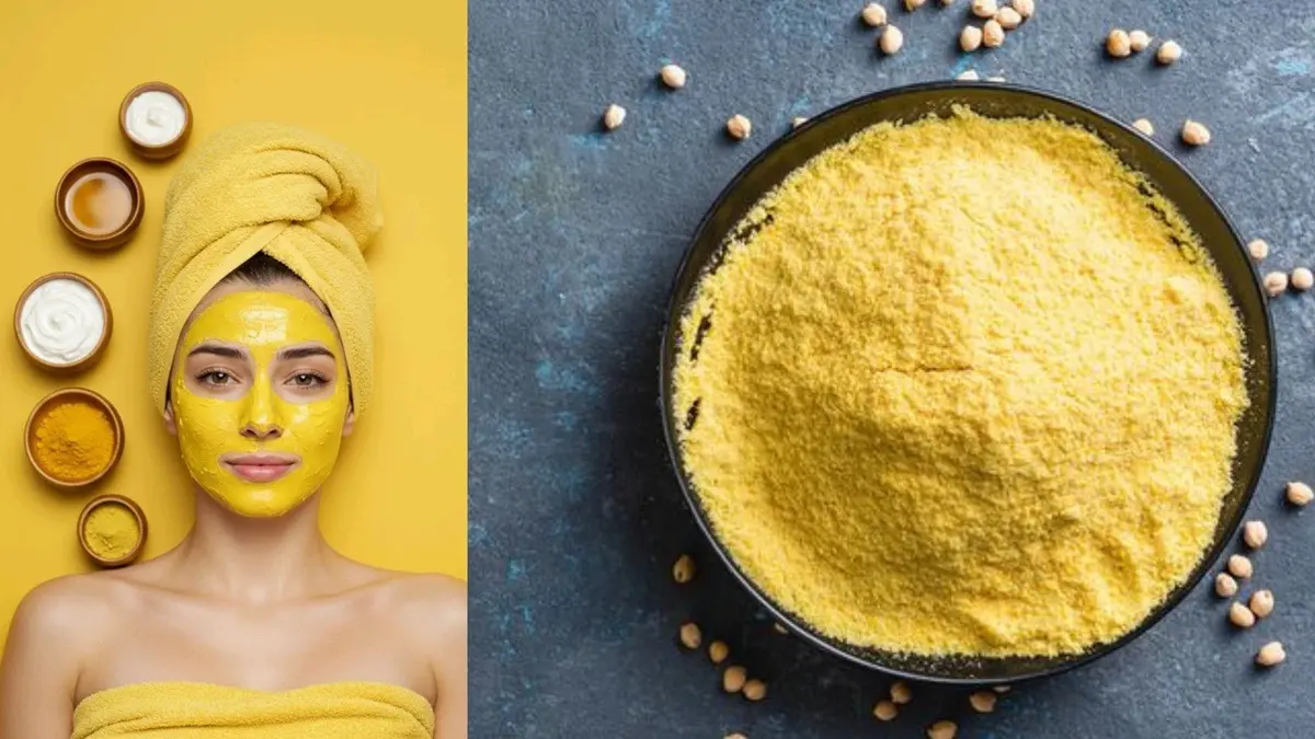 Representation of photo