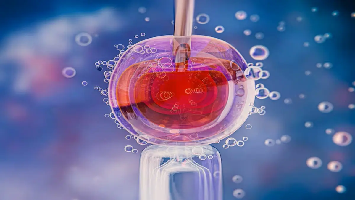 Representation of photo