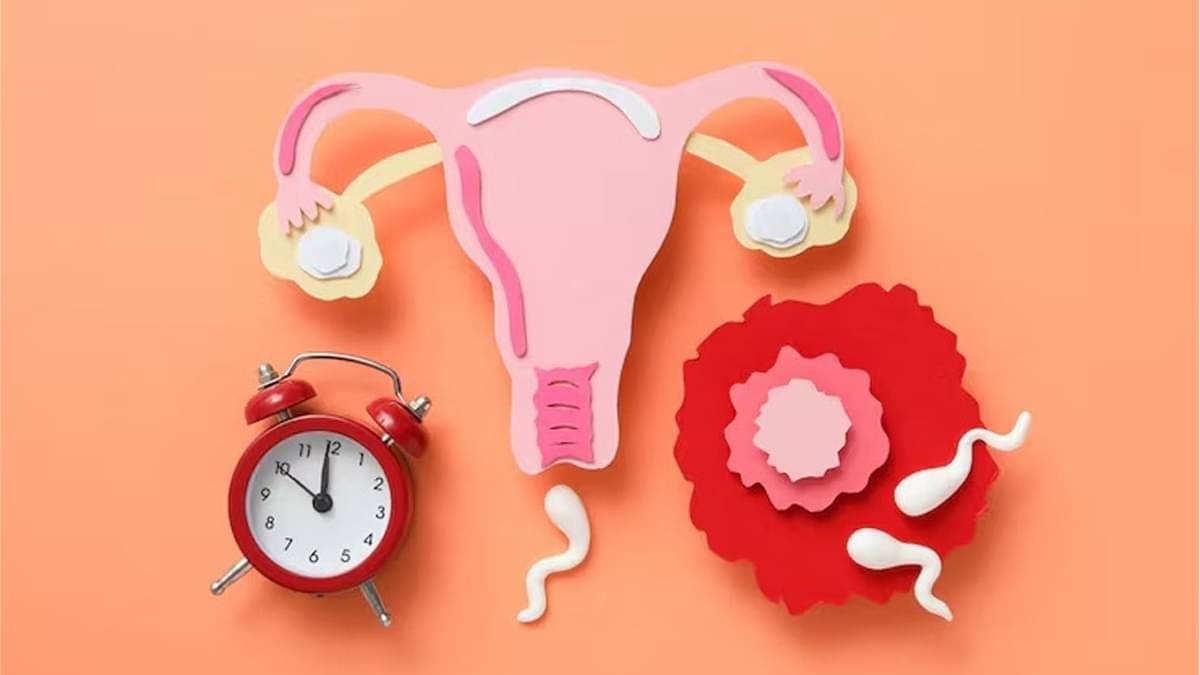 Representation of photo