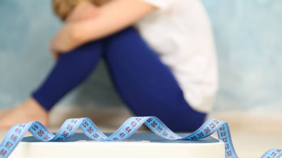 Representation of photo