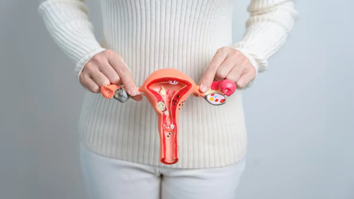 Representation photo