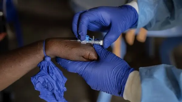 WHO Says Mpox Cases in Congo's Epicenter May Be 'Plateauing' Representative image.