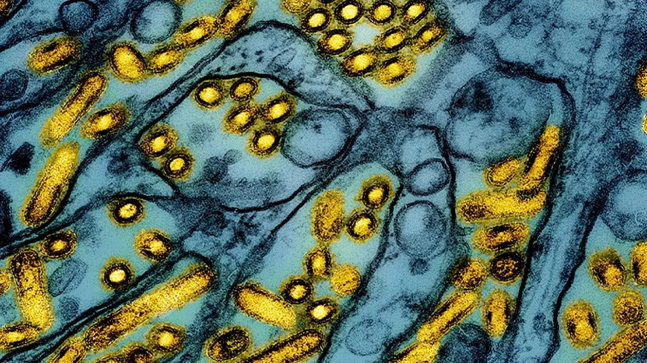California Declared An Emergency Over Bird Flu. How Serious Is The Situation? Representative image