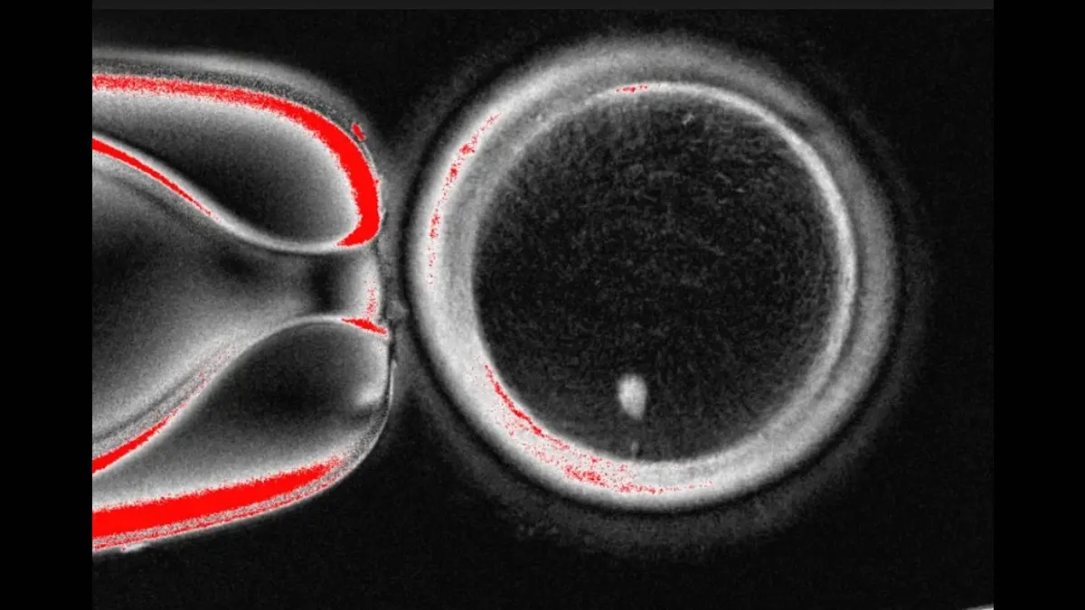 Researchers Convert Skin Cells Into Eggs, But Not Yet Viable