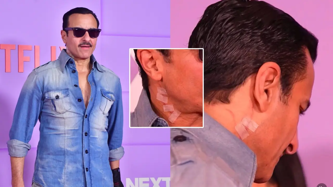 Saif Ali Khan Stabbing Attack: Actor's Neck Scar Photos Go Viral Amid 'Publicity Stunt' Claims Saif Ali Khan's neck injury takes over internet.