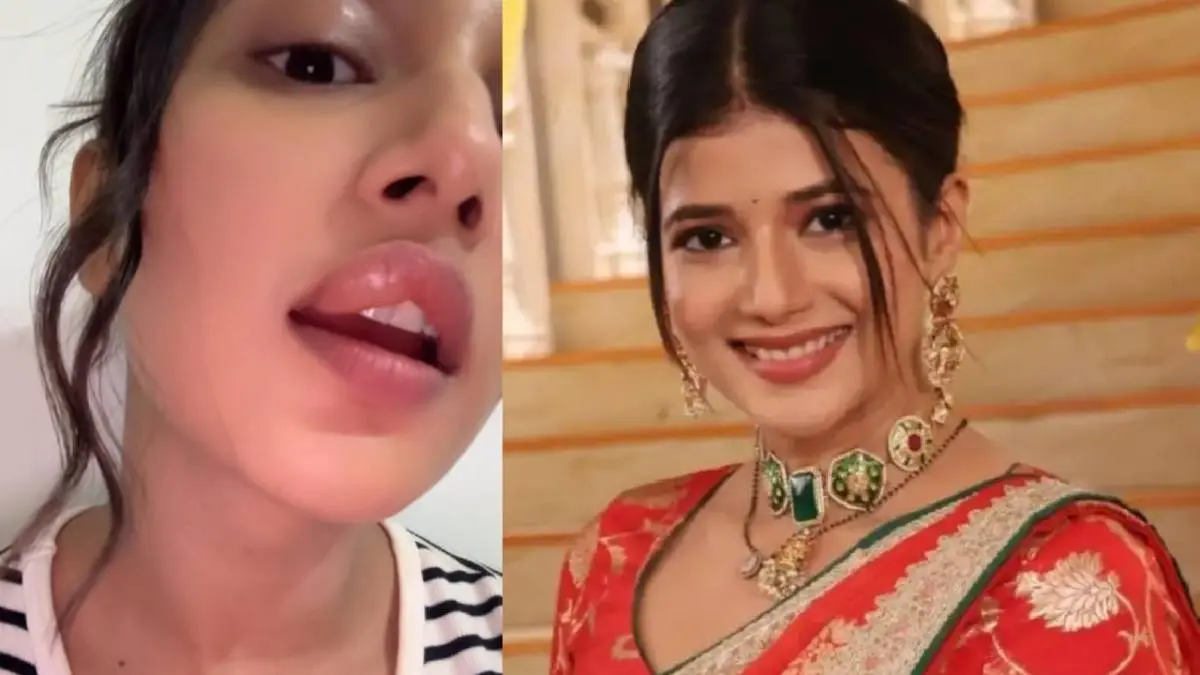 Samridhii Shukla: ‘ये रिश्ता क्या कहलाता है’ की हीरोइन को ये क्या हुआ? सूजे होंठ देख उतरा चेहरा, ऐसे बयां किया दर्द Samridhii Shukla swollen lip
