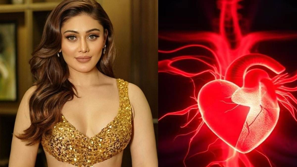 Description of the pic