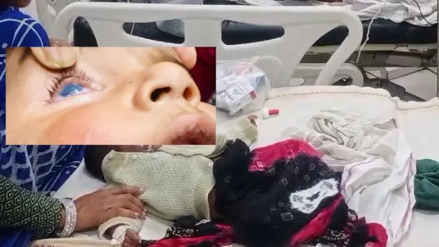 Shivpuri Baby Burn Case