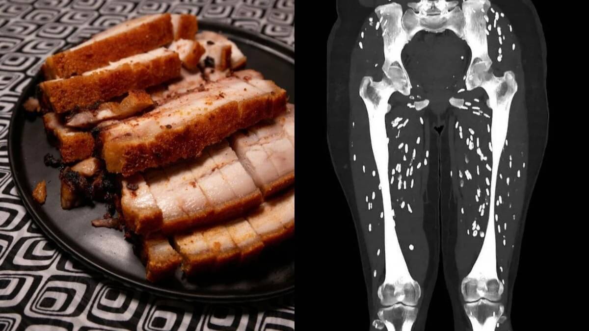 Shocking CT Scan Reveals How Undercooked Pork Affects the Body, See