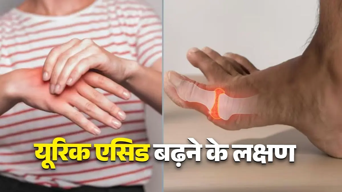 Signs of increased uric acid symptoms avoid these food items to control uric acid and for healthy body diet tips