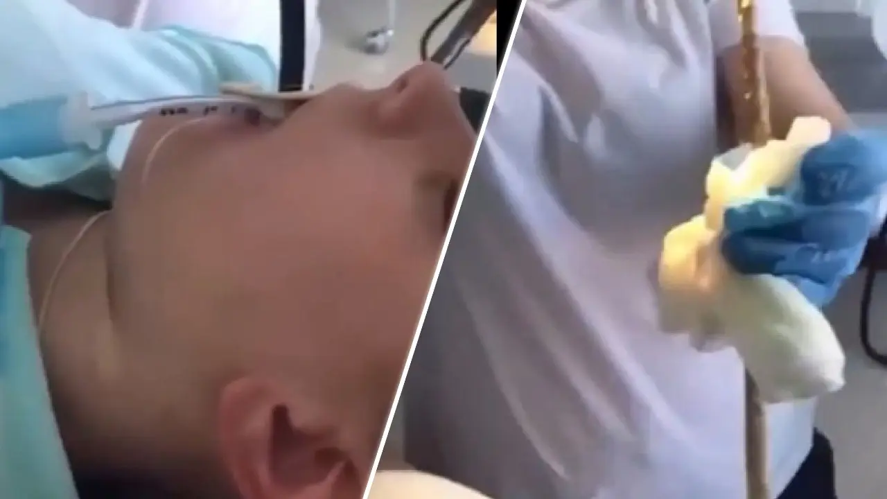 Snake entered woman's mouth