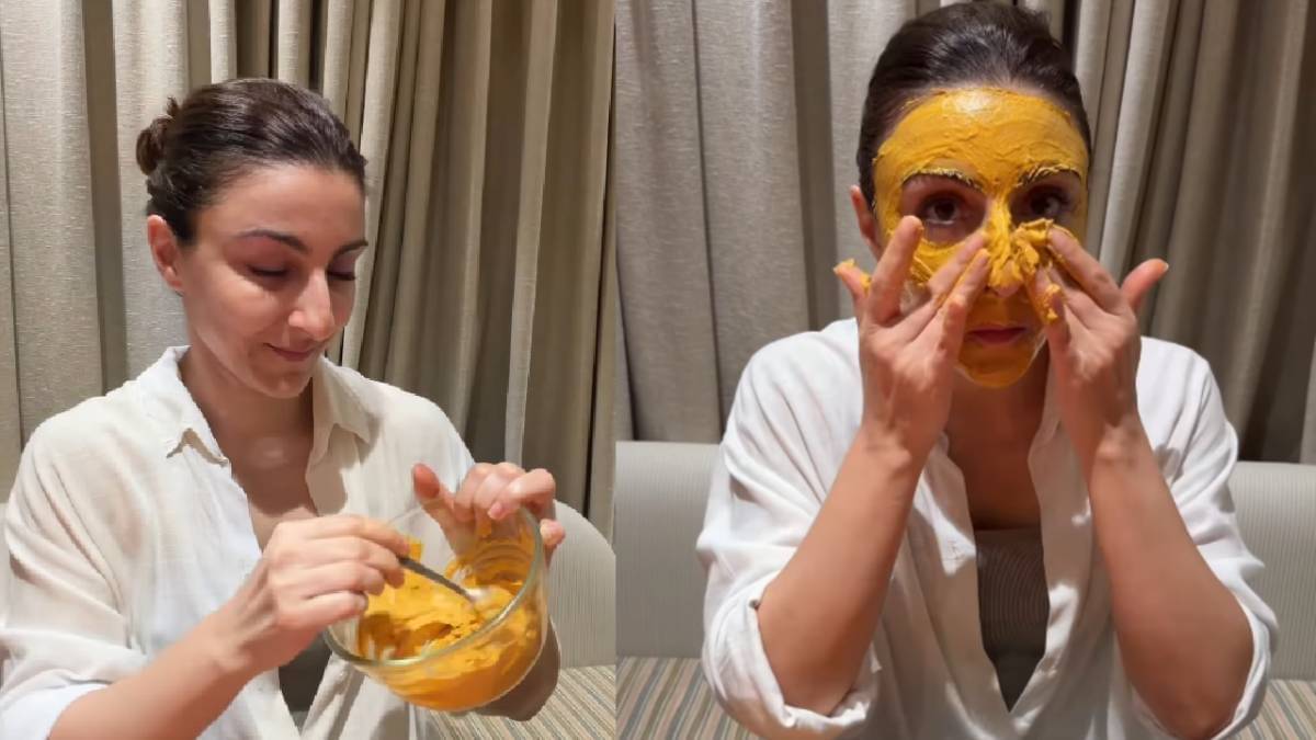 Description of the pic