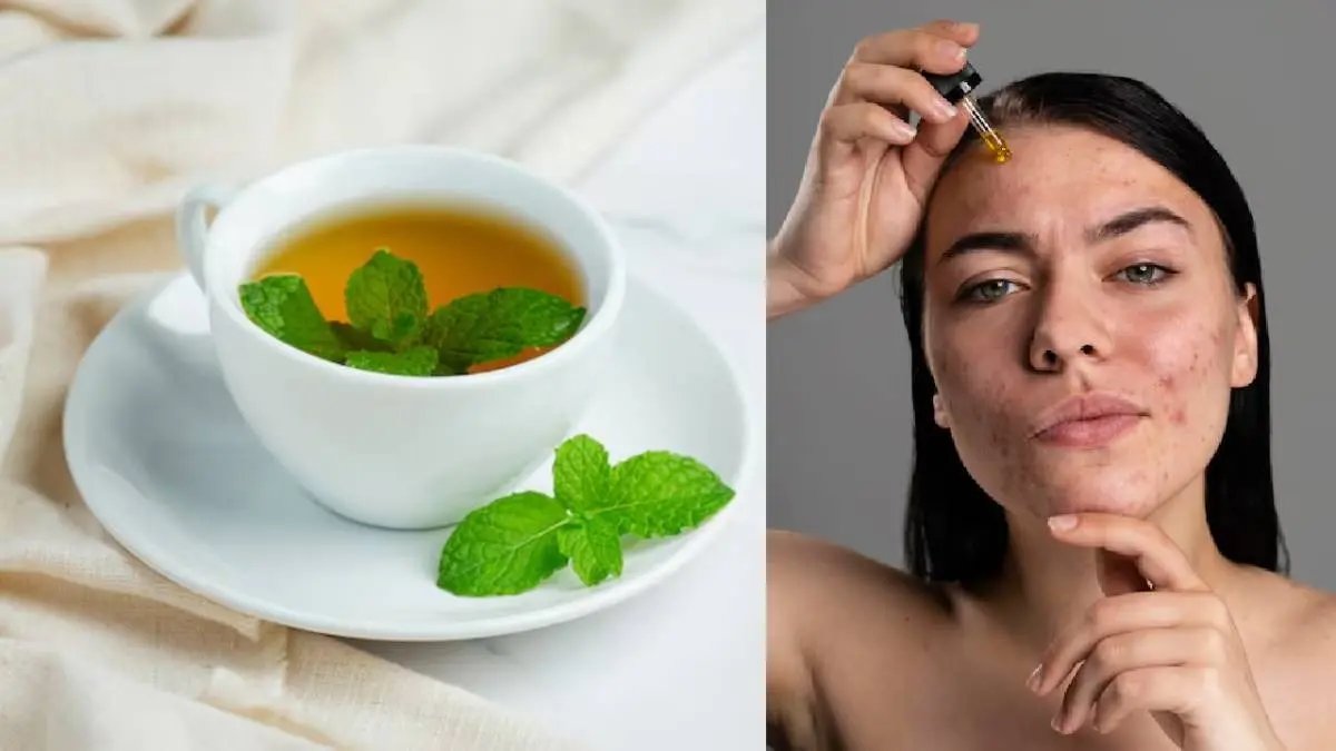 Spearmint Tea for pimples