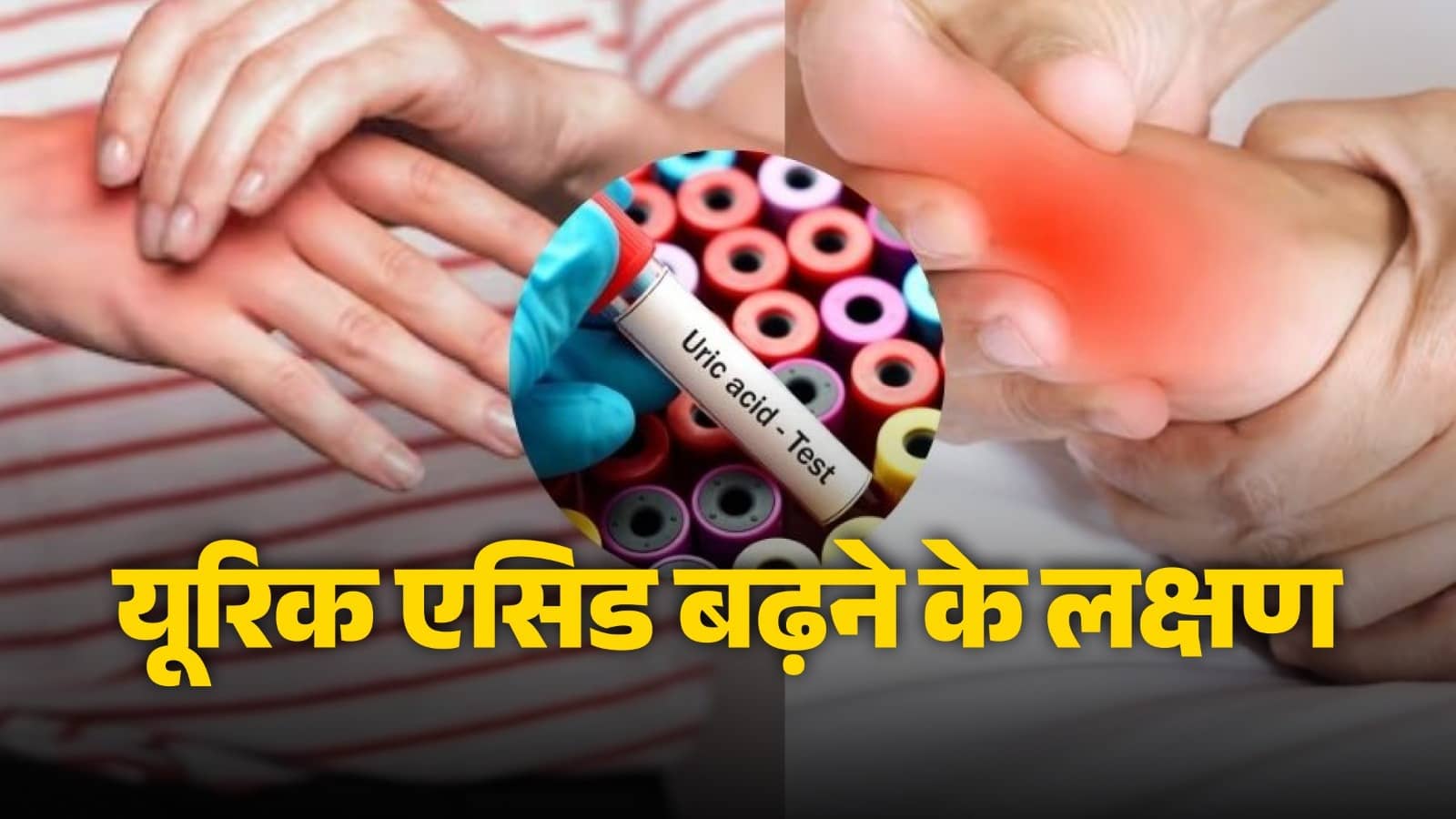 symptoms of high uric acid signs avoid doing these things to stay fit and healthy diet tips