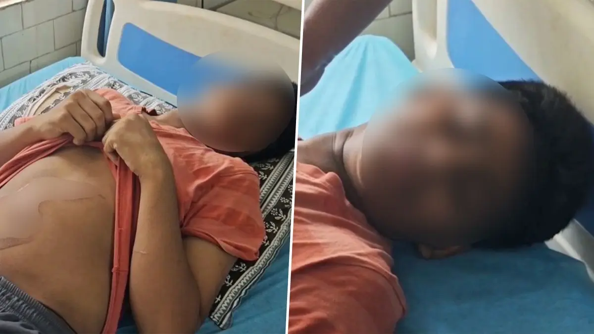 ‘They Threatened to Kill Me’: 16-Year-Old Brutally Ragged, Burnt with Hot Iron Box at Andhra Hostel; Mother Seeks Justice ‘They Threatened to Kill Me’: 16-Year-Old Brutally Ragged, Burnt with Hot Iron Box at Andhra Hostel; Mother Seeks Justice