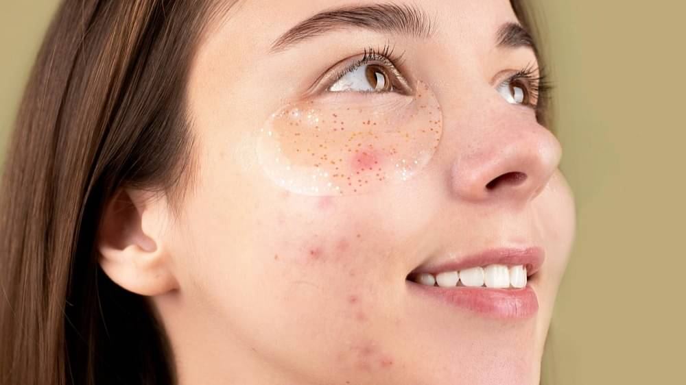 Description of the pic