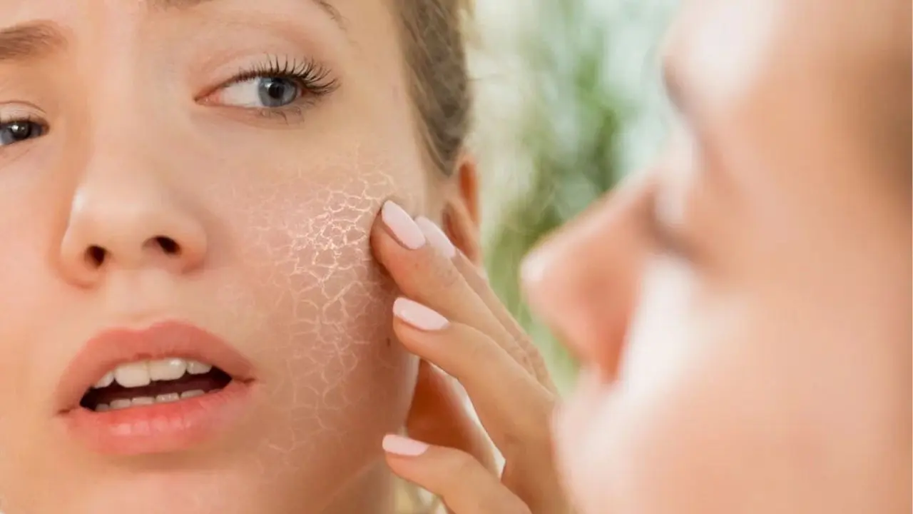Tips To Prevent And Treat Dry, Dehydrated Skin During Hot Summer Days