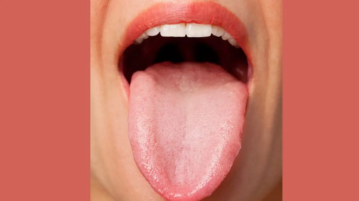 Tongue Health