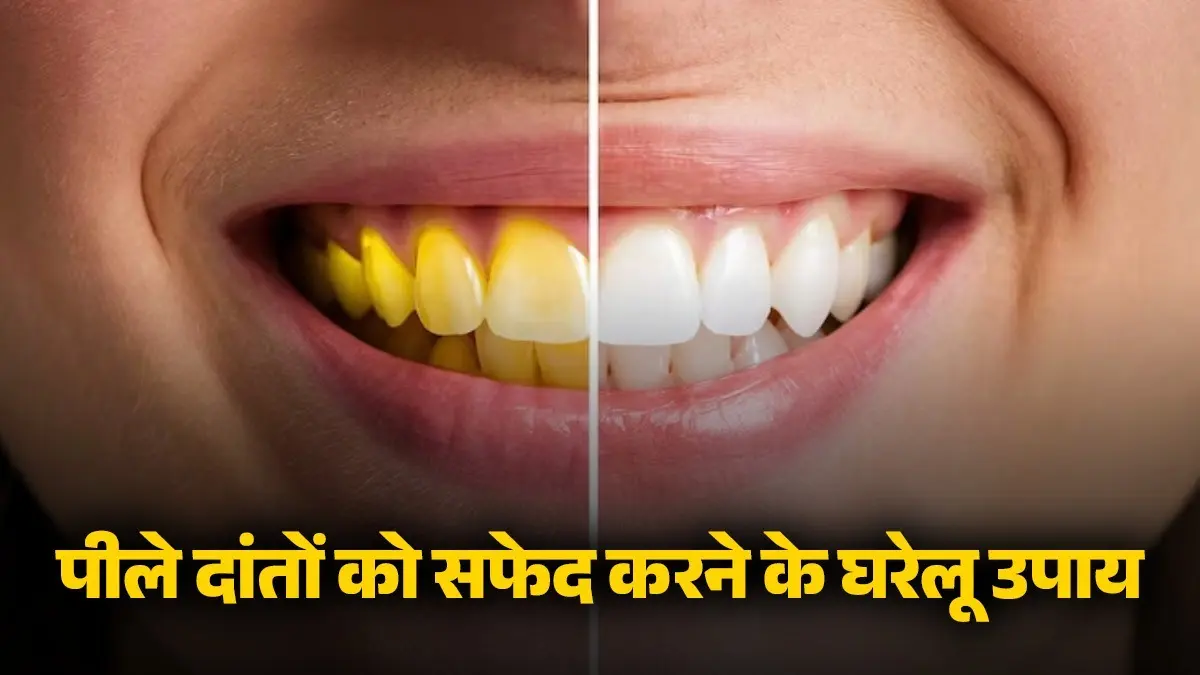 tooth whitening treatment from yellow to white teeth home remedies