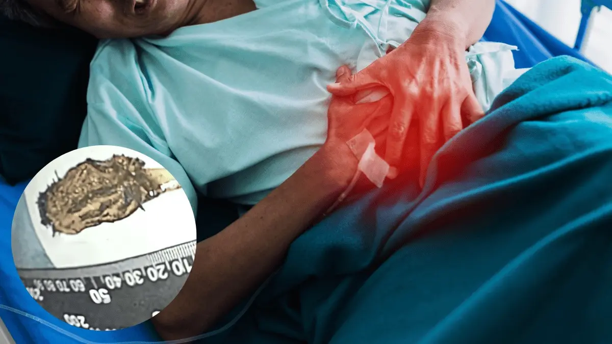 Toothbrush Found in Man’s Intestines- 52 Years After He Swallowed It