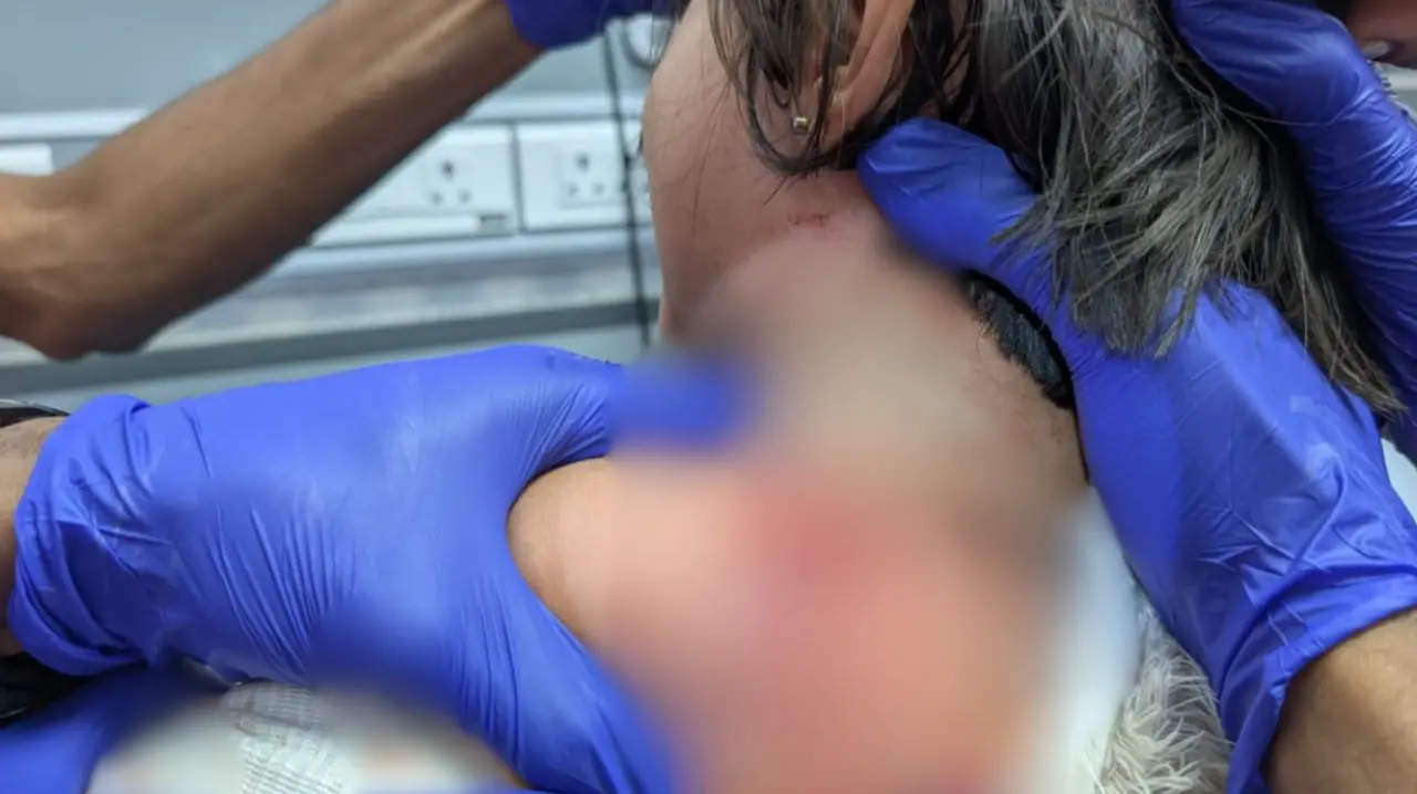 In a horrifying incident, a 2-year-old girl was critically injured after being attacked by a pitbull dog in Bengaluru's Subbanapalya area on December 23