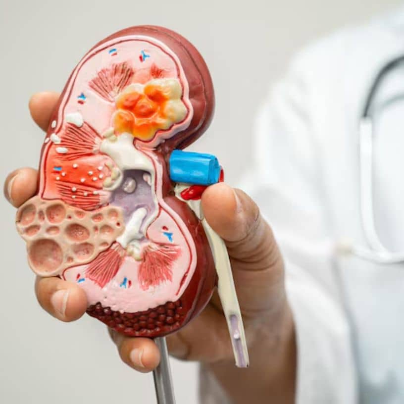 Description of the pic