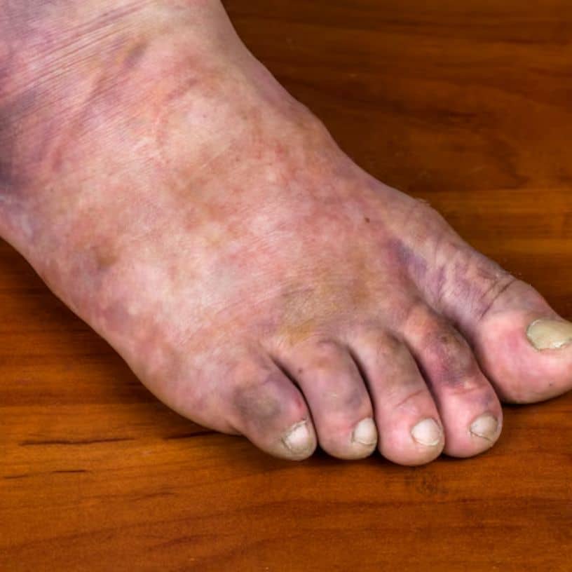 Description of the pic