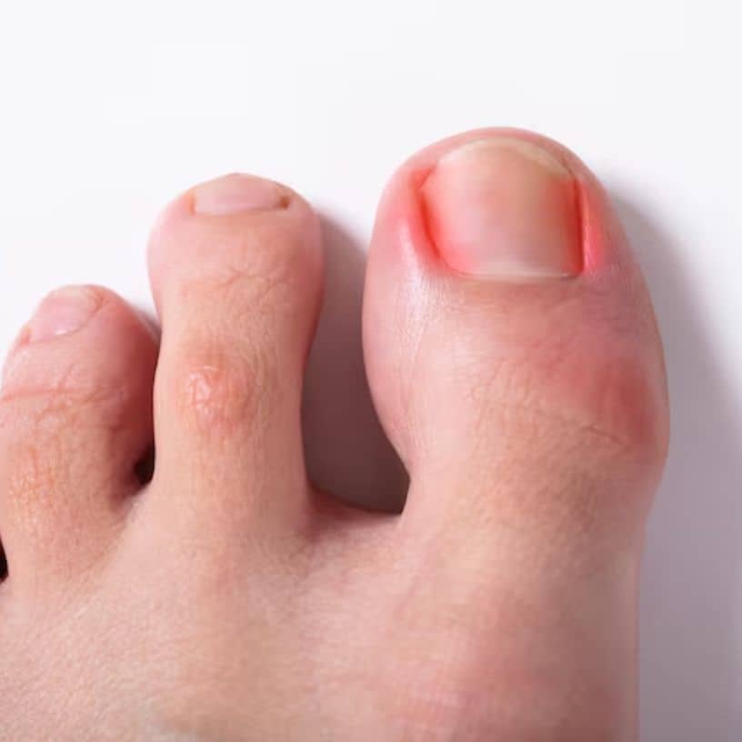 Description of the pic