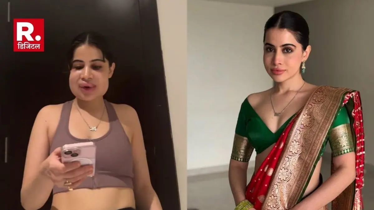 urfi javed face swollen Lip Filler Remover Treatment