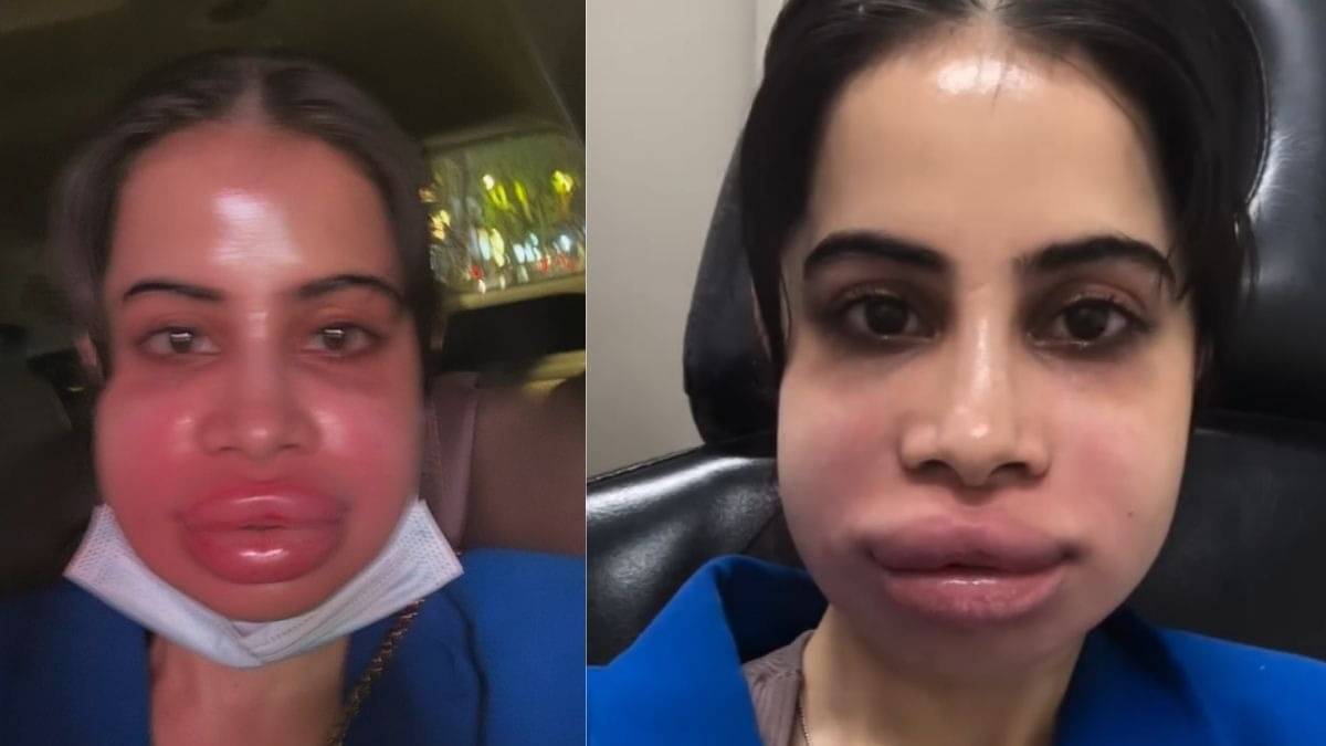 Description of the pic