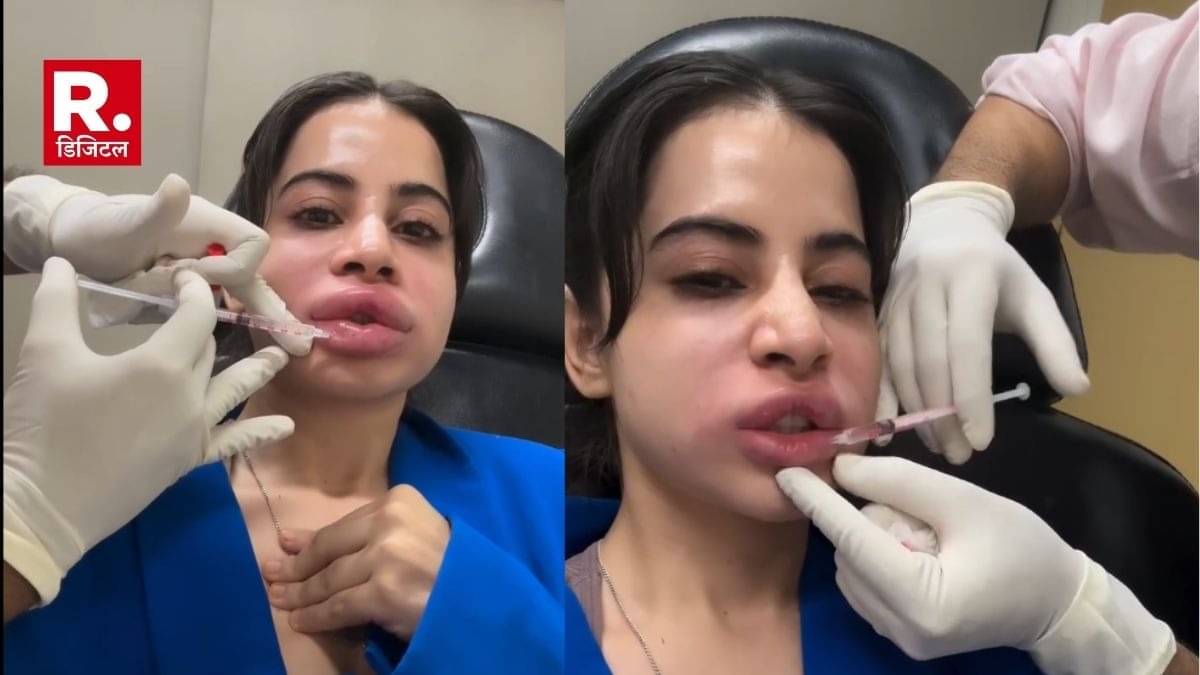 Description of the pic