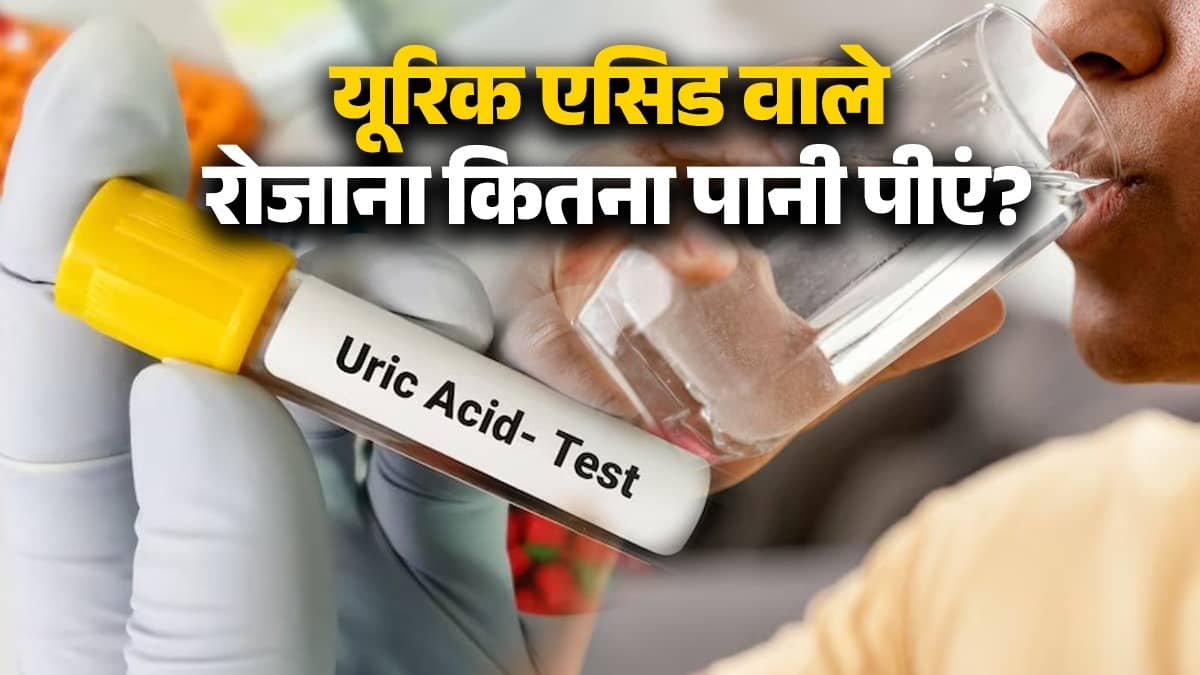 Uric Acid