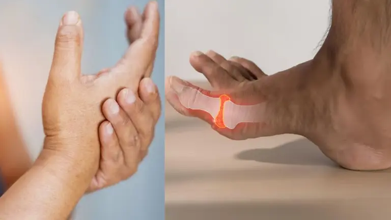 Uric Acid Problem: क्यों बढ़ता है शरीर में यूरिक एसिड? जानें क्या खाएं और किन चीजों से करें परहेज uric acid increases why know how to control it what to eat healthy diet tips for fit body