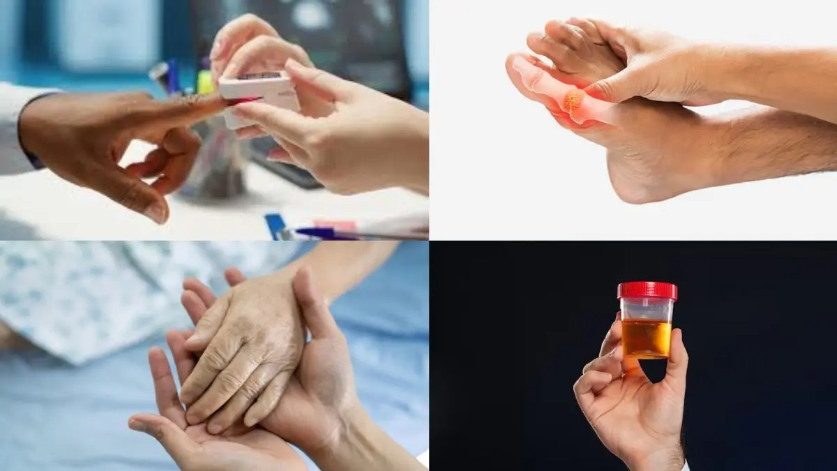 Uric Acid Symptoms: ये 5 संकेत बताते हैं शरीर में बढ़ रहा यूरिक एसिड, इन तरीकों से तुरंत करें कंट्रोल Uric Acid Symptoms