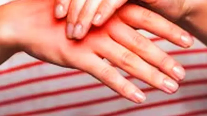 What is the disease that causes tingling in hands and feet