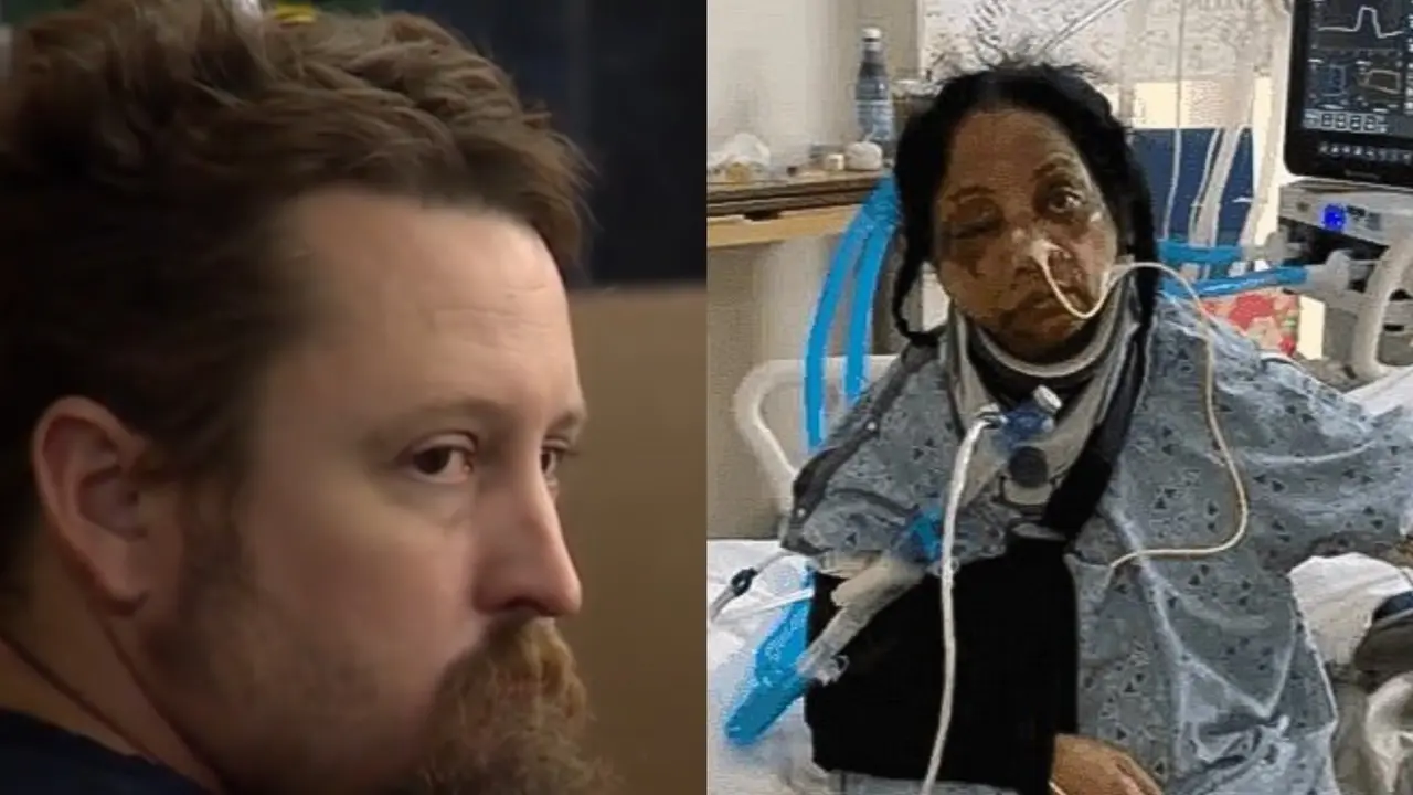 US Patient Attacks Indian-Origin Nurse