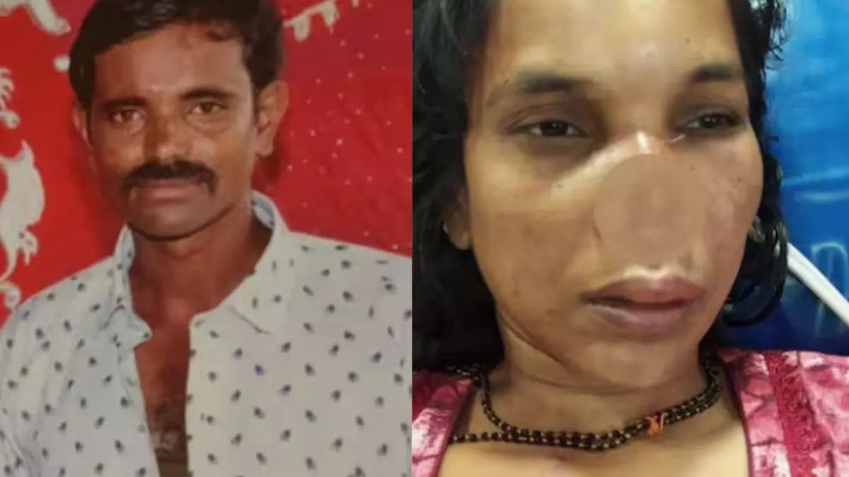 Man Bites Off Wife’s Nose During Heated Argument Over Loan Repayment Vijay allegedly bit off Vidhya’s nose, causing severe injuries.