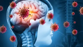 Viral Encephalitis: Early Signs, Symptoms And Treatment Options Viral Encephalitis