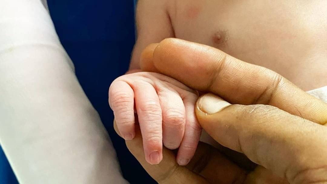 Description of the pic